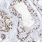 Immunohistochemical staining of human testis shows high expression.