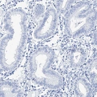 Immunohistochemical staining of human endometrium shows low expression as expected.