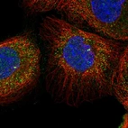 Immunofluorescent staining of human cell line A-431 shows localization to cytosol & centrosome.