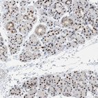 Anti-HEMK1 Antibody