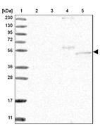 Lane 1: Marker [kDa] 230, 130, 95, 72, 56, 36, 28, 17, 11_br/_Lane 2: Human cell line RT-4_br/_Lane 3: Human cell line U-251 MG_br/_Lane 4: Human plasma_br/_Lane 5: Human Liver tissue
