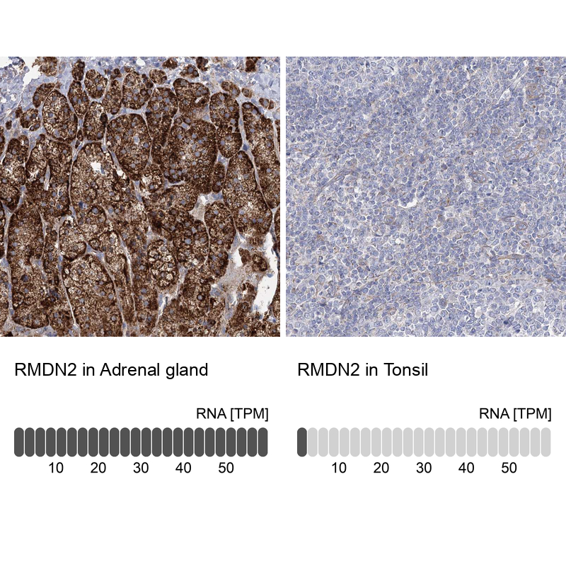 Anti-RMDN2 Antibody