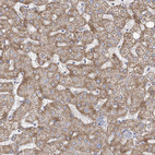 Immunohistochemical staining of human liver shows moderate cytoplasmic positivity in hepatocytes.