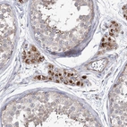 Immunohistochemical staining of human testis shows strong cytoplasmic positivity in Leydig cells.