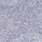 Immunohistochemical staining of human tonsil shows no positivity in non-germinal center cells as expected.