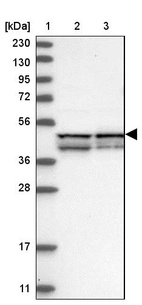 Lane 1: Marker [kDa] 230, 130, 95, 72, 56, 36, 28, 17, 11_br/_Lane 2: Human cell line RT-4_br/_Lane 3: Human cell line U-251MG sp