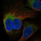 Immunofluorescent staining of human cell line U-2 OS shows localization to cytosol, the Golgi apparatus & mitotic spindle.