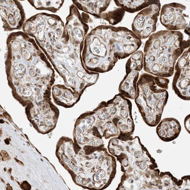 Anti-METTL21A Antibody