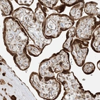 Anti-METTL21A Antibody