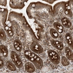 Immunohistochemical staining of human duodenum shows strong cytoplasmic positivity in glandular cells.