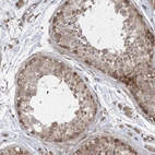 Immunohistochemical staining of human testis shows weak to moderate cytoplasmic positivity in cells in seminiferous ducts.