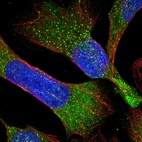 Immunofluorescent staining of human cell line U-2 OS shows localization to vesicles.