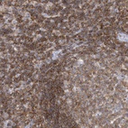 Anti-PSD4 Antibody