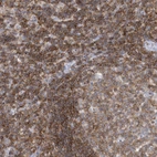 Immunohistochemical staining of human tonsil shows high expression.