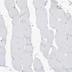 Immunohistochemical staining of human skeletal muscle shows low expression as expected.