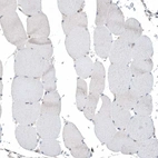 Immunohistochemical staining of human skeletal muscle shows low expression as expected.