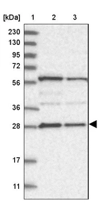 Lane 1: Marker [kDa] 230, 130, 95, 72, 56, 36, 28, 17, 11_br/_Lane 2: Human cell line RT-4_br/_Lane 3: Human cell line U-251MG sp
