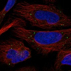 Immunofluorescent staining of human cell line U-2 OS shows localization to vesicles.