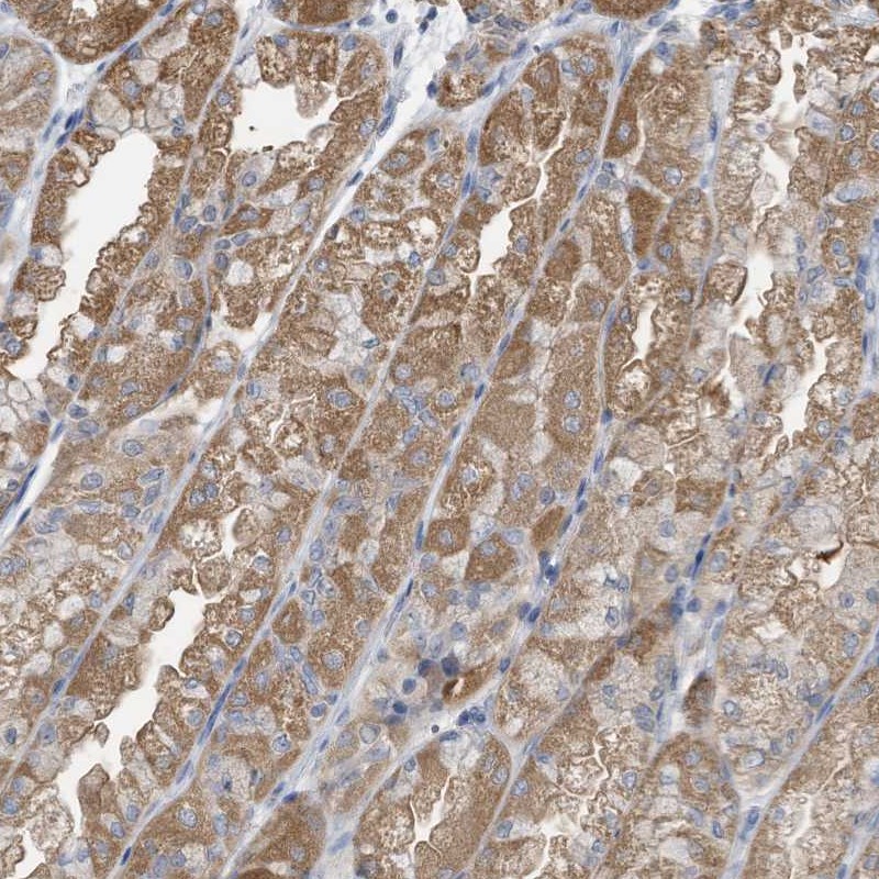Anti-LDAH Antibody