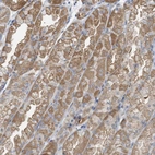 Anti-LDAH Antibody