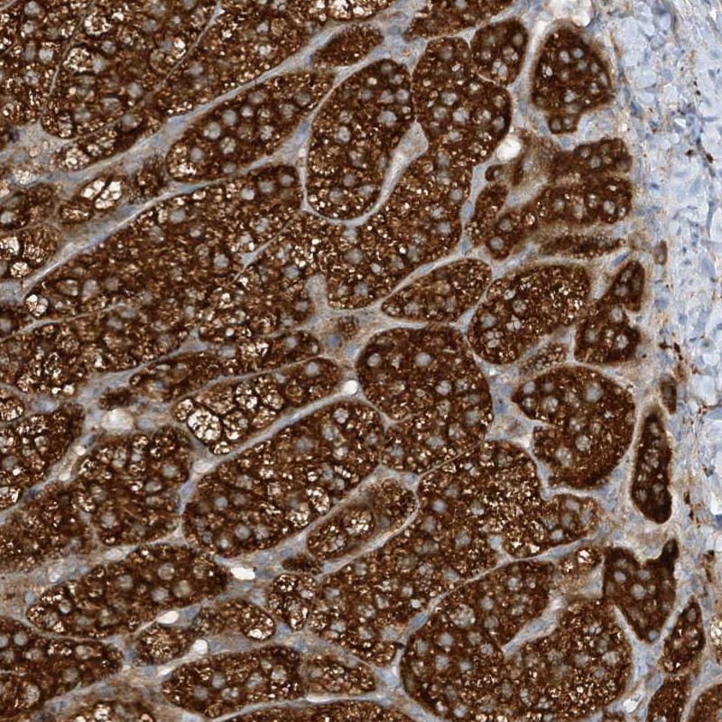 Anti-LDAH Antibody