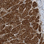 Anti-LDAH Antibody