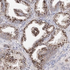 Anti-C3orf38 Antibody