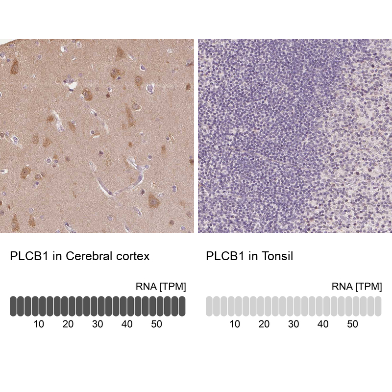 Anti-PLCB1 Antibody