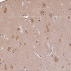 Immunohistochemical staining of human Cerebral cortex shows moderate cytoplasmic positivity in neurons.
