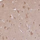 Immunohistochemical staining of human Cerebral cortex shows moderate cytoplasmic positivity in neurons.