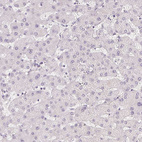 Immunohistochemical staining of human Liver shows very weak cytoplasmic positivity in hepatocytes.