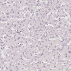 Anti-PLCB1 Antibody