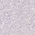 Immunohistochemical staining of human Liver shows very weak cytoplasmic positivity in hepatocytes.