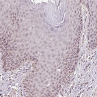 Immunohistochemical staining of human Skin shows very weak cytoplasmic positivity in squamous epithelial cells.