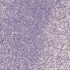 Immunohistochemical staining of human Tonsil shows no positivity in non-germinal center cells as expected.