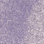 Immunohistochemical staining of human Tonsil shows no positivity in non-germinal center cells as expected.