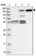 Lane 1: Marker [kDa] 250, 130, 95, 72, 55, 36, 28, 17, 10_br/_Lane 2: Human cell line RT-4_br/_Lane 3: Human cell line U-251 MG_br/_Lane 4: Human plasma