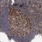 Immunohistochemical staining of human lymph node shows strong nuclear positivity in germinal center cells.