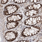 Immunohistochemical staining of human colon shows strong nuclear positivity in glandular cells.