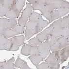 Immunohistochemical staining of human skeletal muscle shows no positivity in myocytes as expected.