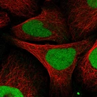 Immunofluorescent staining of human cell line U-2 OS shows localization to nucleoplasm.