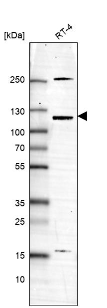 Anti-USP43 Antibody