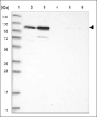 Anti-PTK2 Antibody