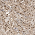 Anti-ZBTB41 Antibody
