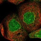 Immunofluorescent staining of human cell line A-431 shows localization to nucleus, nuclear membrane & cytosol.