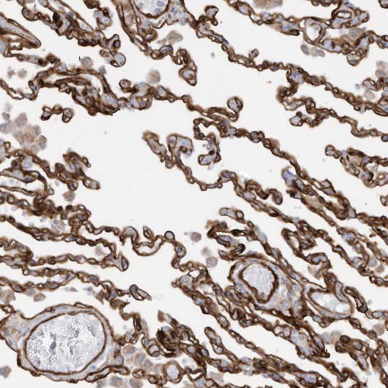 Anti-ABCB7 Antibody