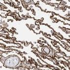 Anti-ABCB7 Antibody