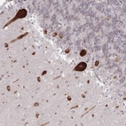 Anti-EEF1B2 Antibody