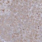 Anti-C21orf58 Antibody