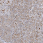 Anti-C21orf58 Antibody